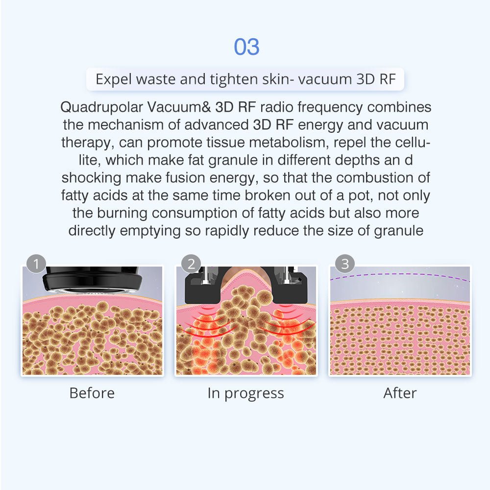 Shape Tactics 5-in-1 Unoisetion Ultrasonic RF Cavitation System – Cavitation Machines, view 10
