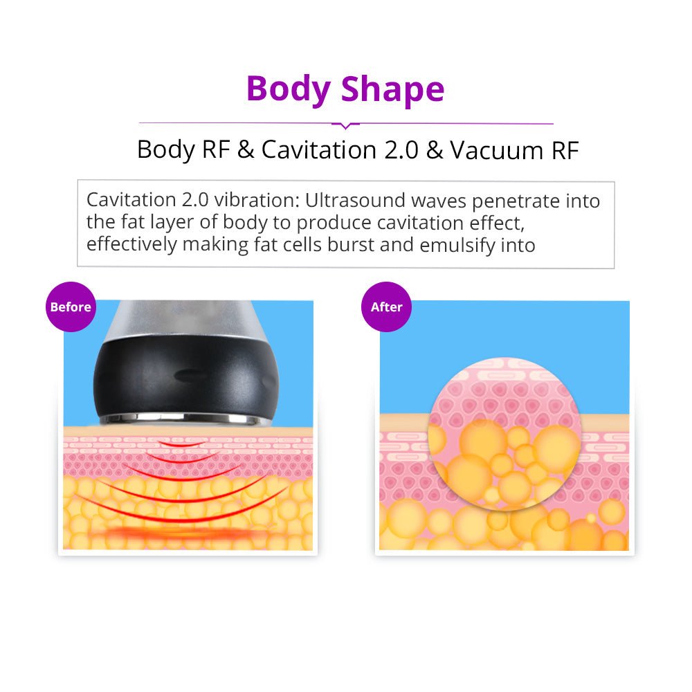 Shape Tactics 5-in-1 Cavitation RF Vacuum Body Contouring System – Cavitation Machines, view 9
