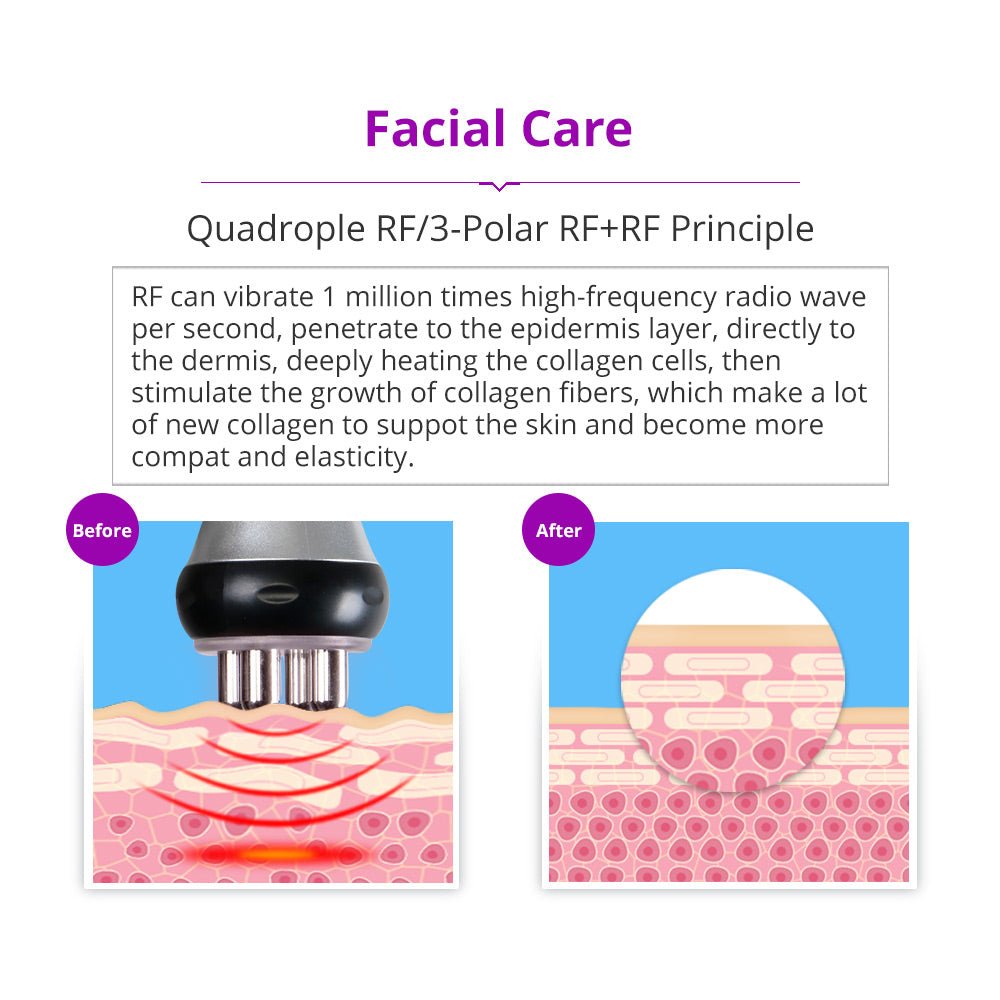 Shape Tactics 5-in-1 Cavitation RF Vacuum Body Contouring System – Cavitation Machines, view 8