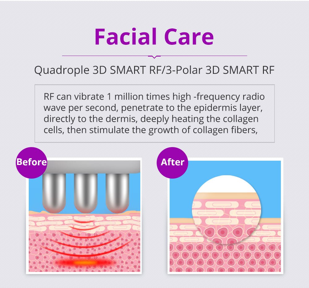 Shape Tactics 6-in-1 40K LED RF Wellness System – Cavitation Machines, view 11