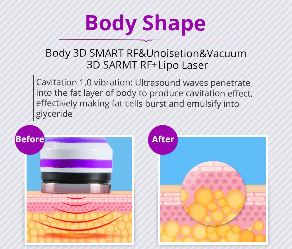 Shape Tactics 6-in-1 40K LED RF Wellness System – Cavitation Machines, view 10