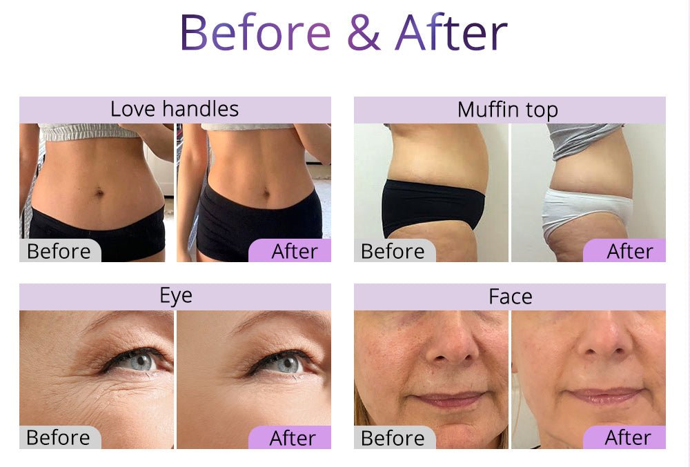 Shape Tactics 6-in-1 Ultrasonic RF Lipo Laser Contouring System – Cavitation Machines, view 13