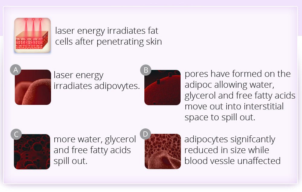 Shape Tactics 6-in-1 Ultrasonic RF Lipo Laser Contouring System – Cavitation Machines, view 12