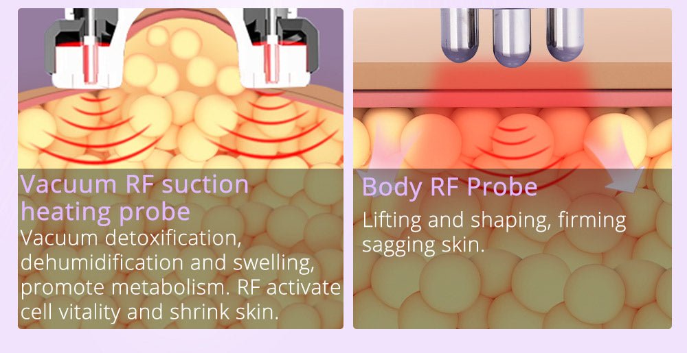 Shape Tactics 6-in-1 Ultrasonic RF Lipo Laser Contouring System – Cavitation Machines, view 9