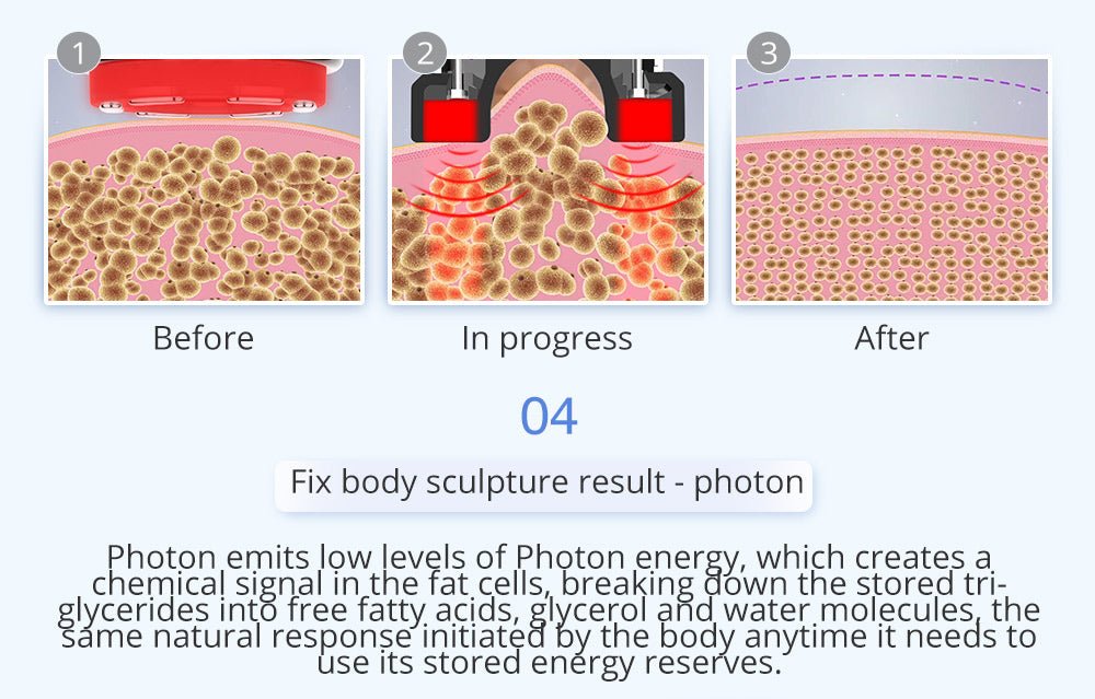 Shape Tactics 6-in-1 Unoisetion Cavitation 2.0 Vacuum RF System – Cavitation Machines, view 13