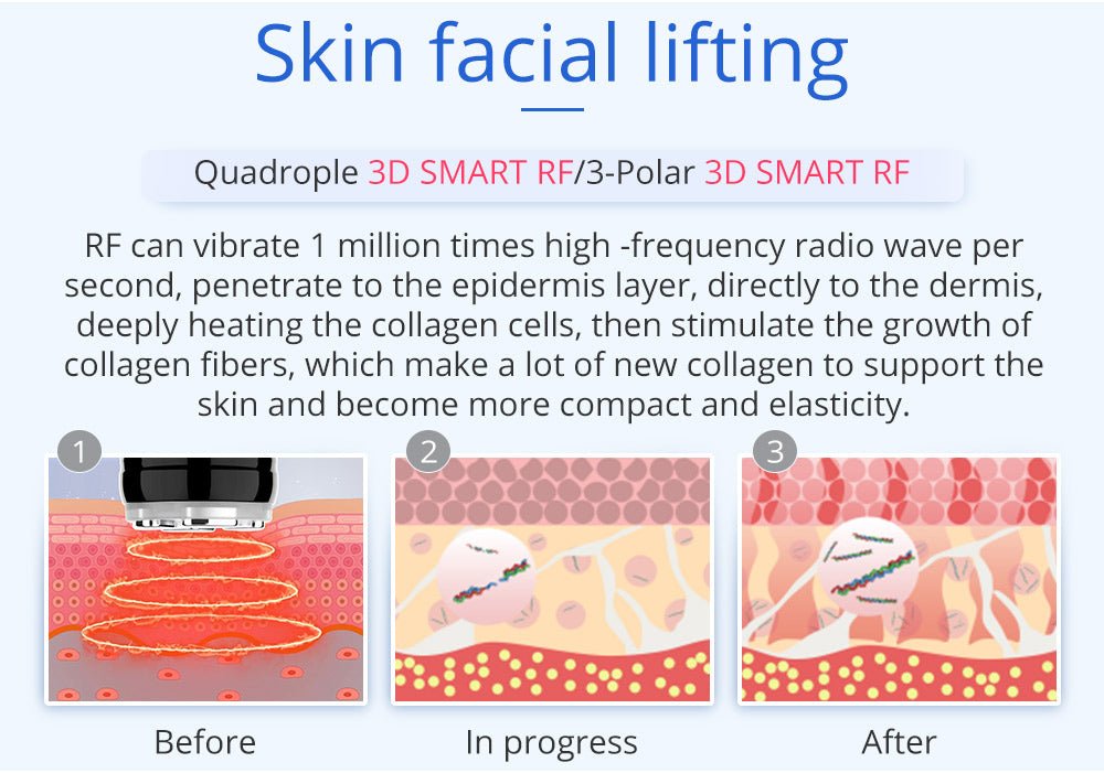 Shape Tactics 6-in-1 Unoisetion Cavitation 2.0 Vacuum RF System – Cavitation Machines, view 16