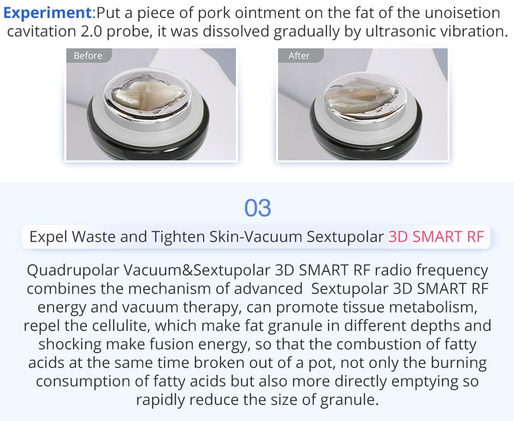 Shape Tactics 6-in-1 Unoisetion Cavitation 2.0 Vacuum RF System – Cavitation Machines, view 12