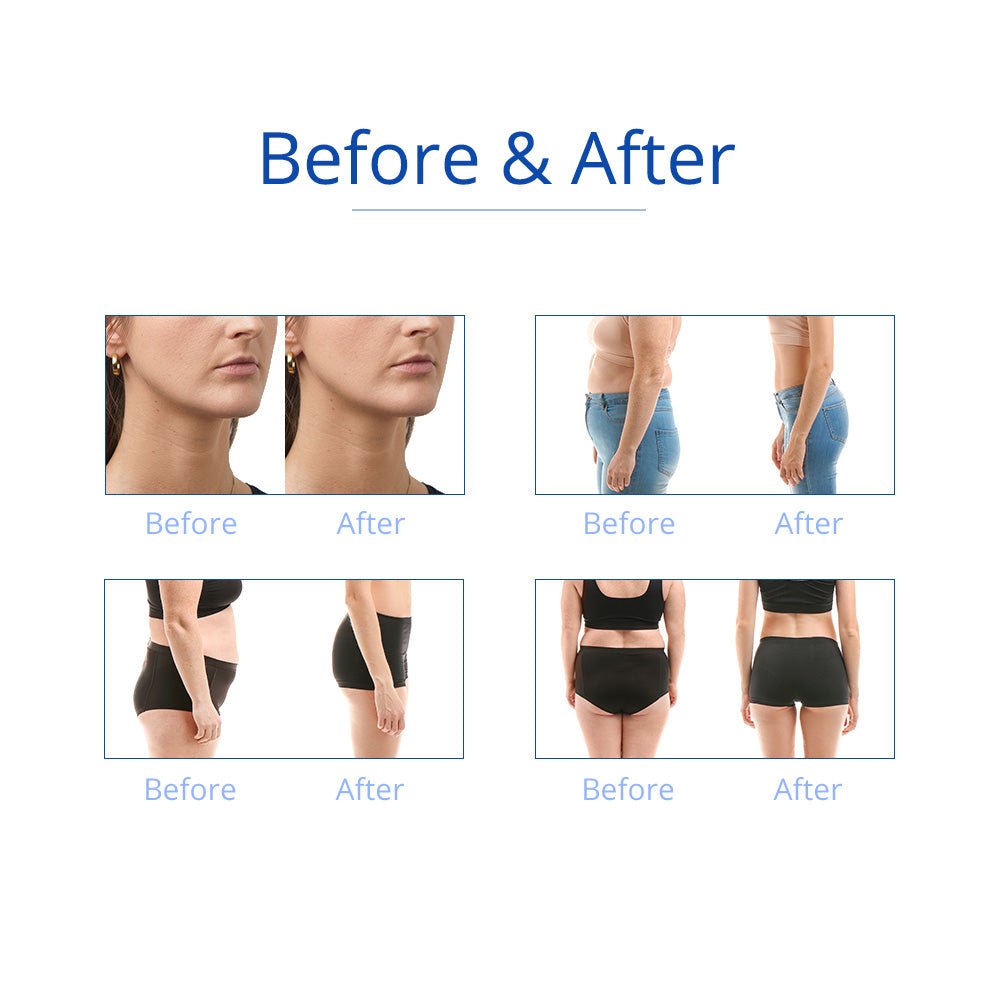 Shape Tactics 6-in-1 Cavitation RF Cryolipolysis Lipo Laser System – Cavitation Machines, view 19
