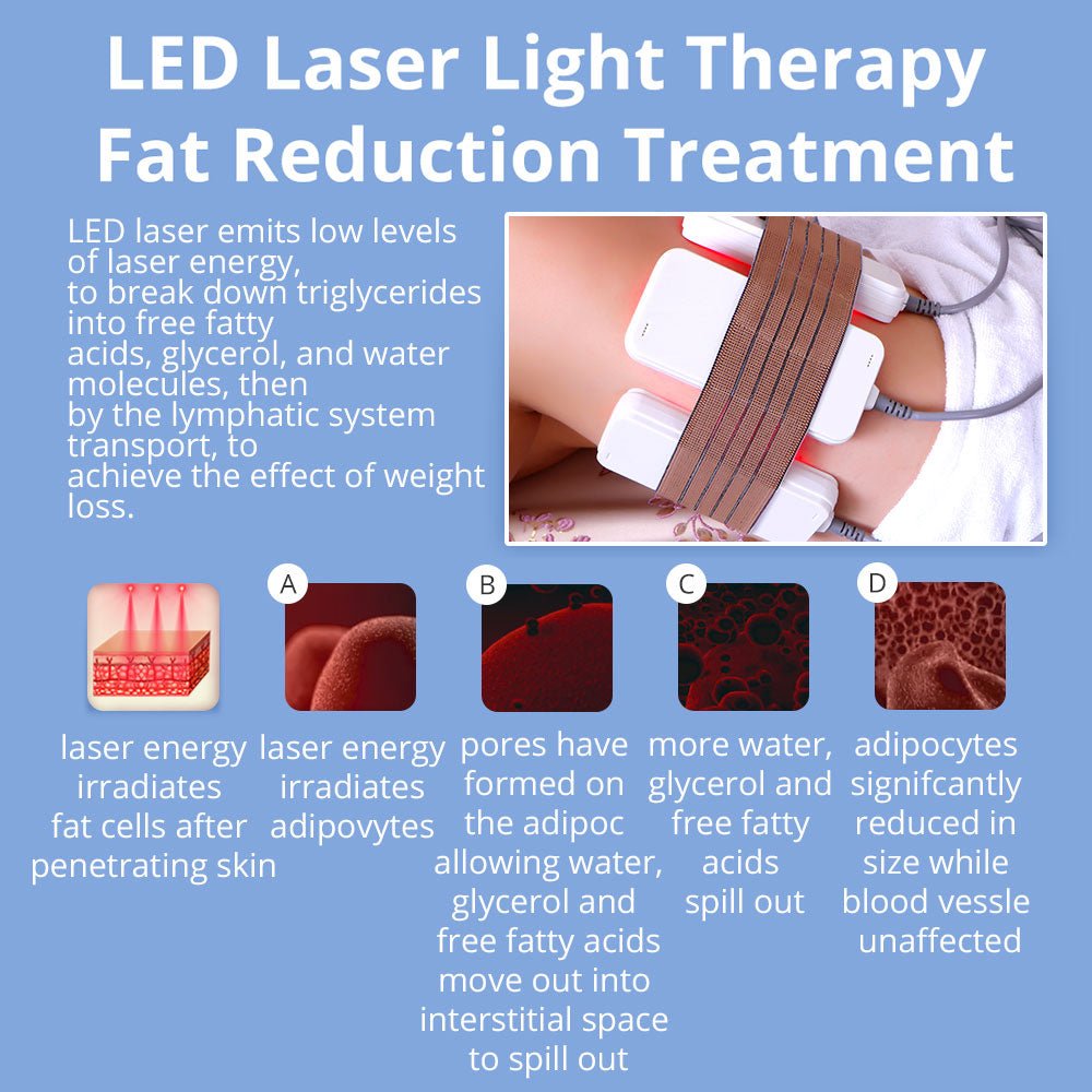 Shape Tactics 6-in-1 Cavitation RF Cryolipolysis Lipo Laser System – Cavitation Machines, view 17