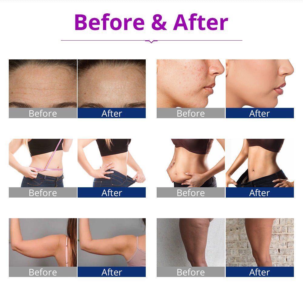Shape Tactics 6-in-1 Cavitation RF LED Laser Lipo System – Cavitation Machines, view 13