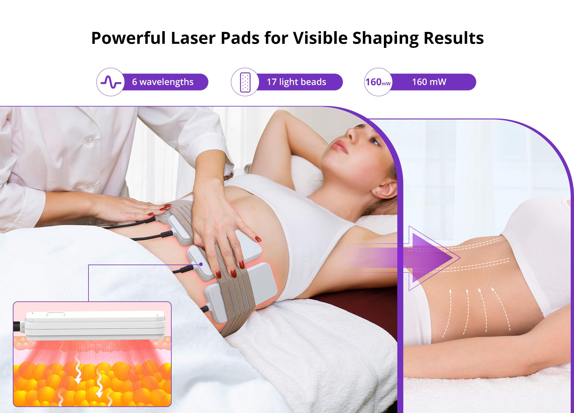 Shape Tactics 6D Body Sculpting LED Laser with 6 Wavelengths – Cavitation Machines, view 14