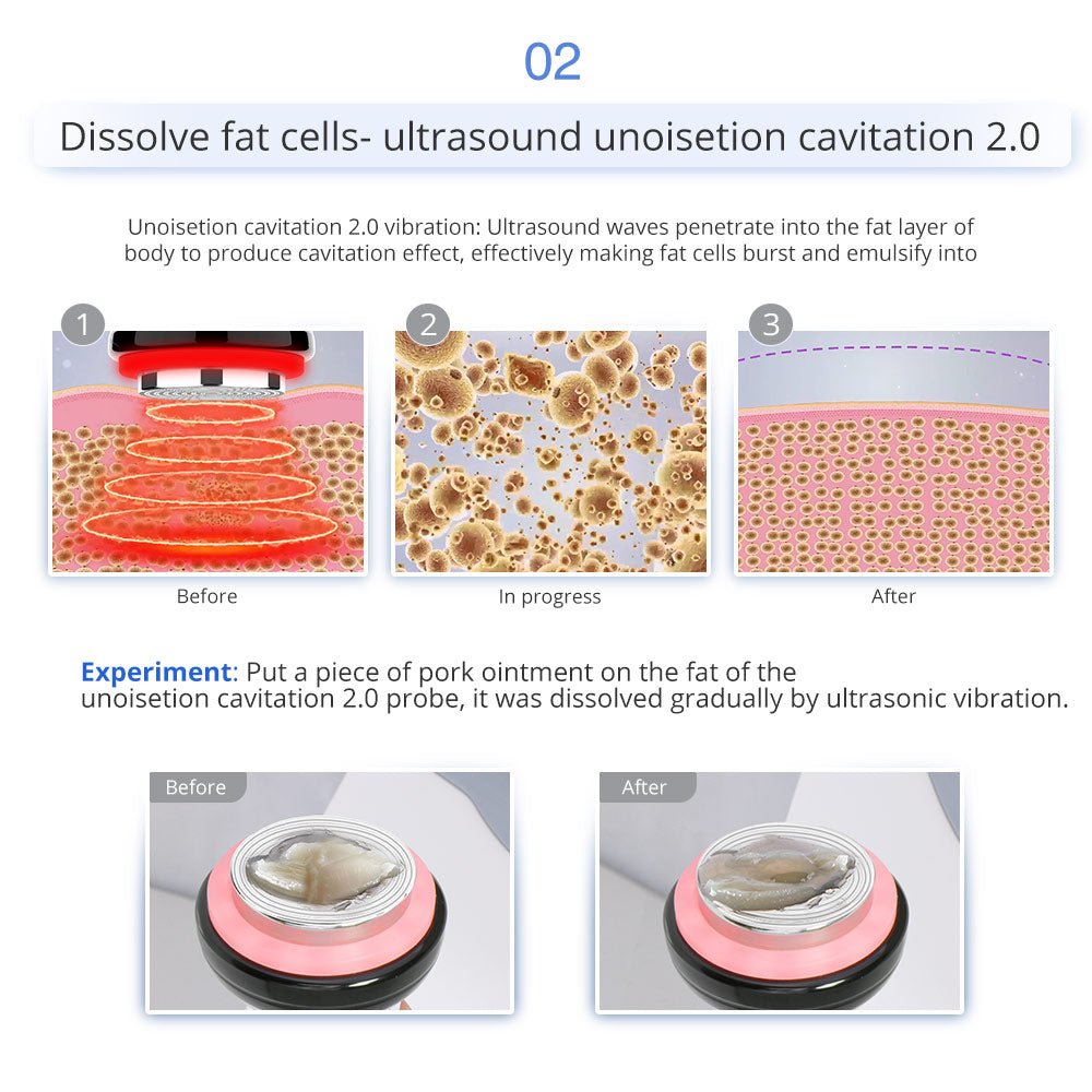 Shape Tactics 7-in-1 40K Ultrasonic Cavitation & RF Hot-Cold Therapy System – Cavitation Machines, view 10