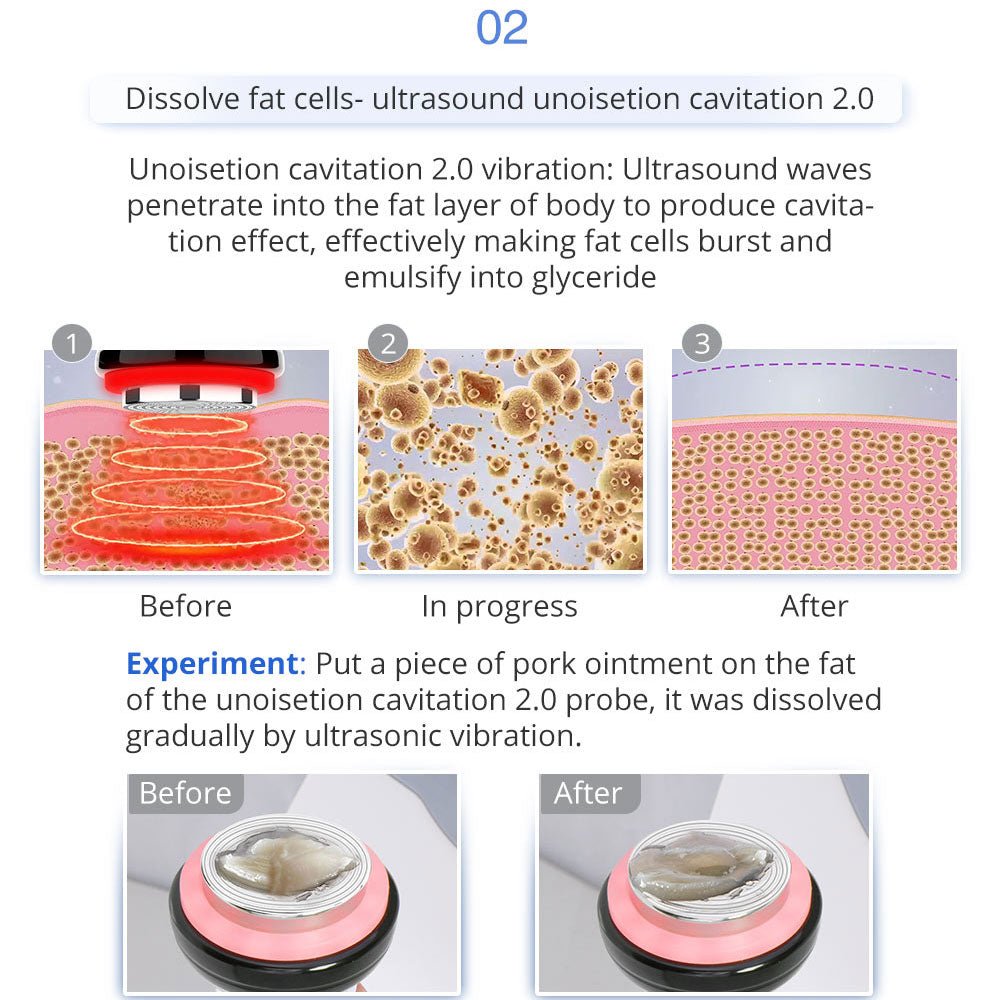 Shape Tactics 8-in-1 Microcurrent RF Cavitation & Laser Contouring System – Cavitation Machines, view 9
