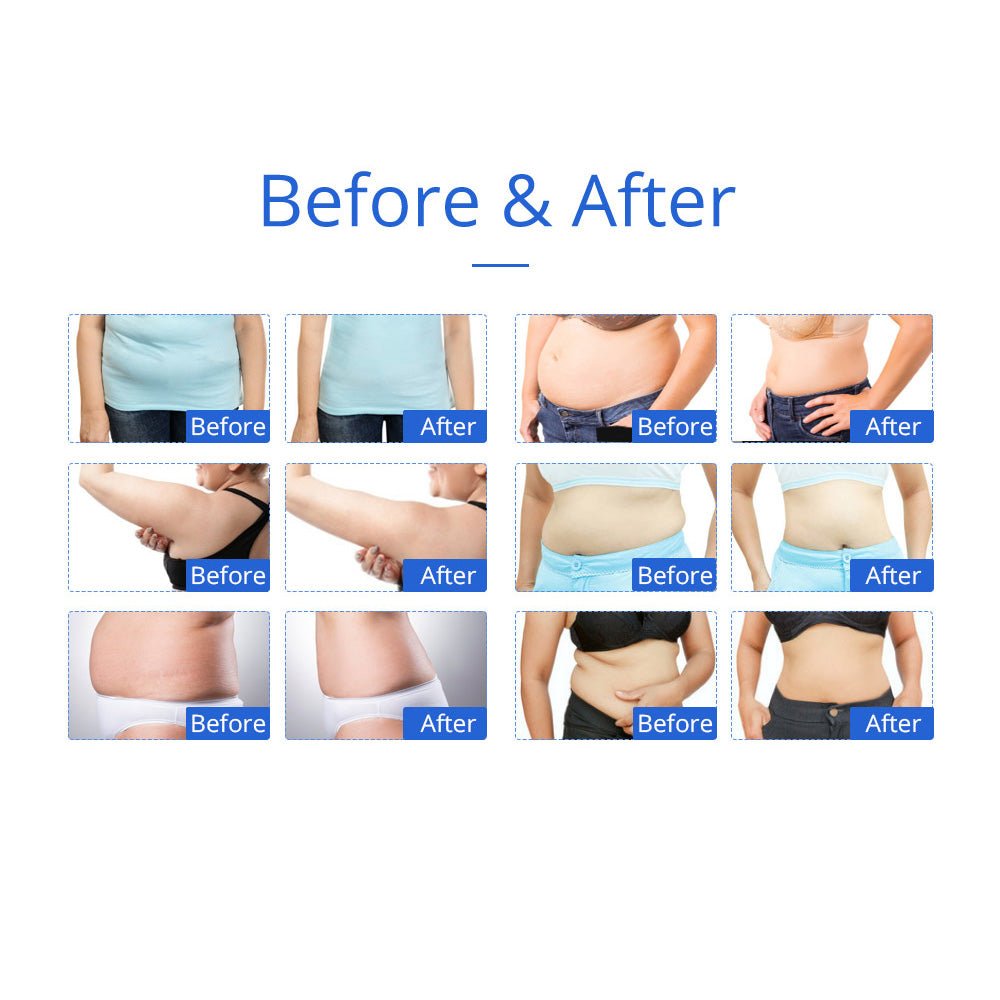 Shape Tactics 8-in-1 Microcurrent RF Cavitation & Laser Contouring System – Cavitation Machines, view 19