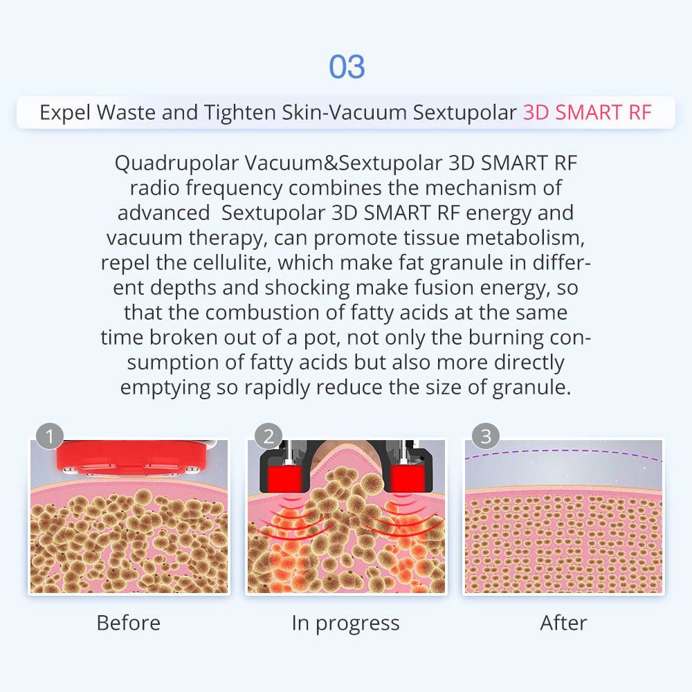 Shape Tactics 8-in-1 Microcurrent RF Cavitation & Laser Contouring System – Cavitation Machines, view 10
