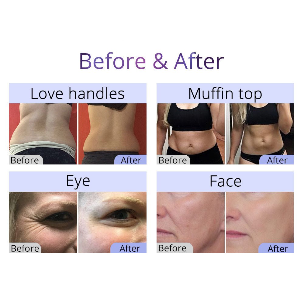 Shape Tactics 8-in-1 RF Cavitation Sculpt System – Cavitation Machines, view 8