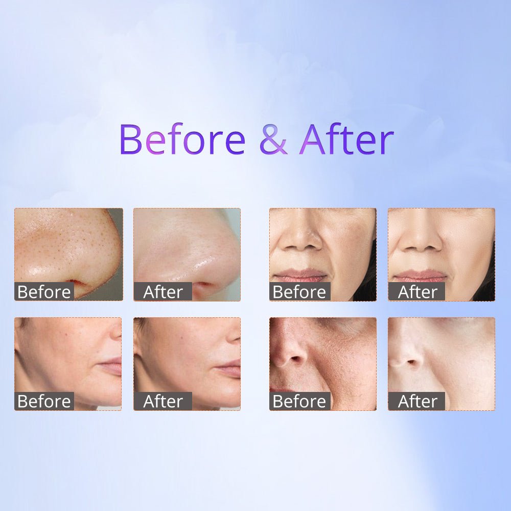 Shape Tactics 8-in-1 RF Skin Tightening System with Hot & Cold Hammer and BIO Therapy – Cavitation Machines, view 16