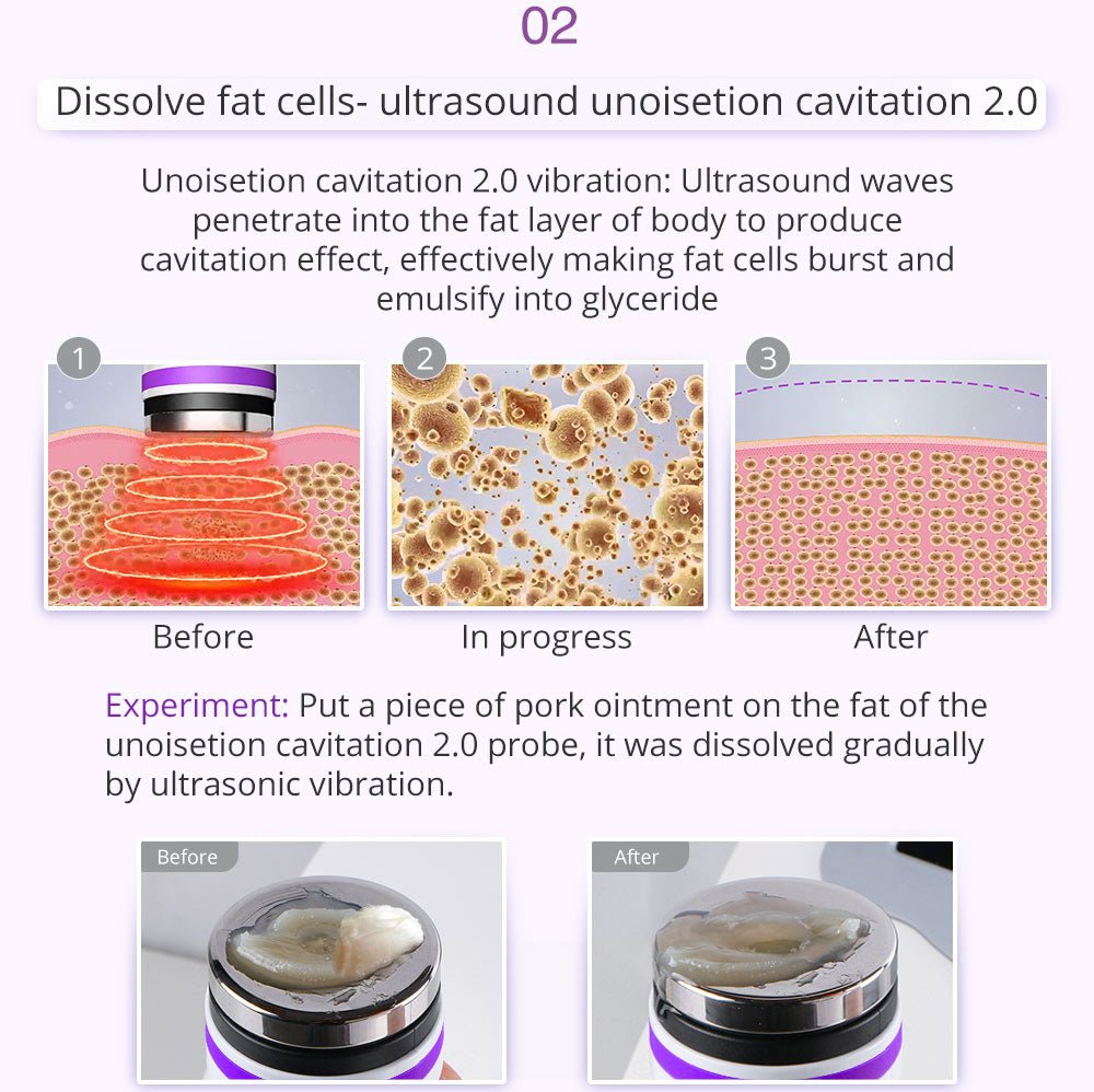Shape Tactics 9-in-1 Lipo Microcurrent Photon Ultrasonic Cavitation System – Cavitation Machines, view 14