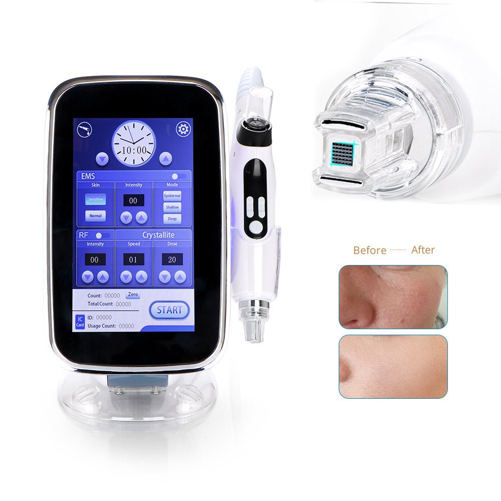 Shape Tactics 2-in-1 RF EMS Mesotherapy Skin Rejuvenation System – Cavitation Machines, view 8