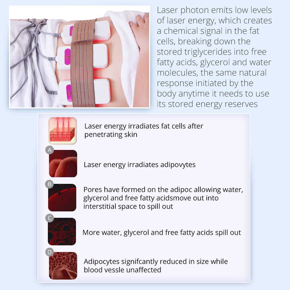 Shape Tactics Advanced 5-in-1 Cryolipolysis 40K Cavitation RF Lipo Laser System – Cavitation Machines, view 10