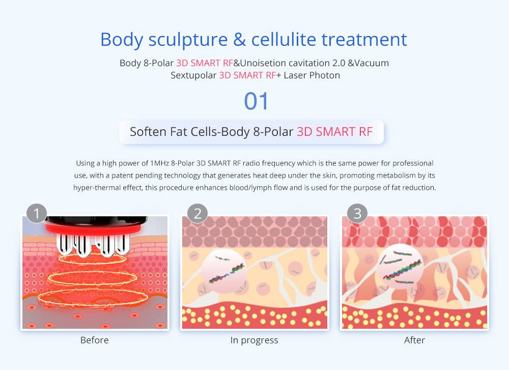 Shape Tactics Advanced 8-in-1 Unoisetion Cavitation & RF System with LED Laser Pads – Cavitation Machines, view 10