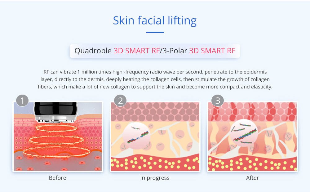 Shape Tactics Advanced 8-in-1 Unoisetion Cavitation & RF System with LED Laser Pads – Cavitation Machines, view 15