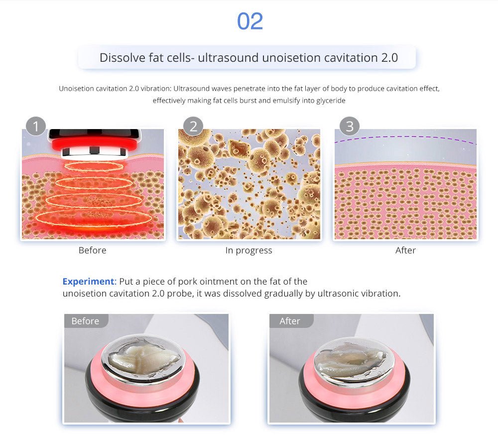 Shape Tactics Advanced 8-in-1 Unoisetion Cavitation & RF System with LED Laser Pads – Cavitation Machines, view 11