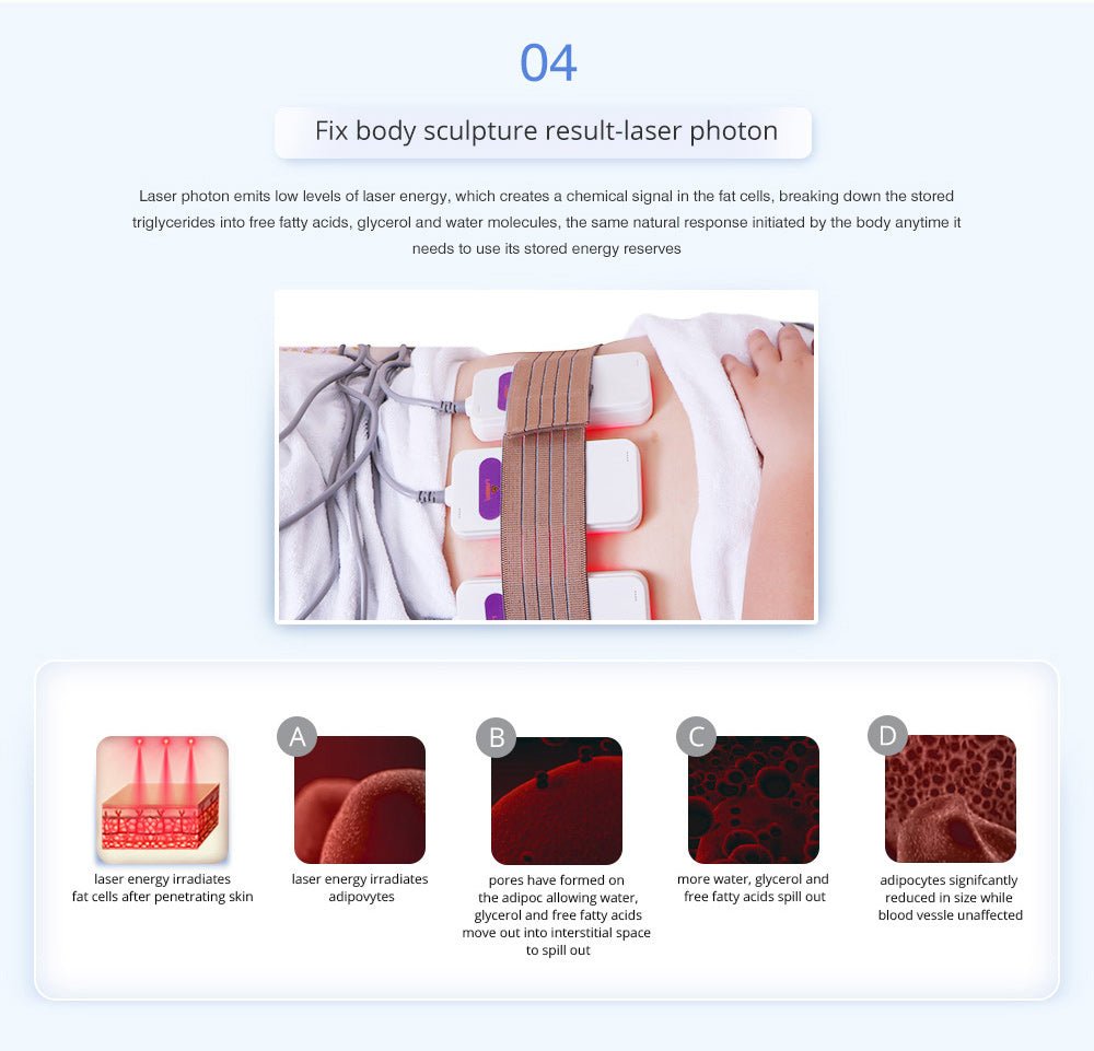 Shape Tactics Advanced 8-in-1 Unoisetion Cavitation & RF System with LED Laser Pads – Cavitation Machines, view 13