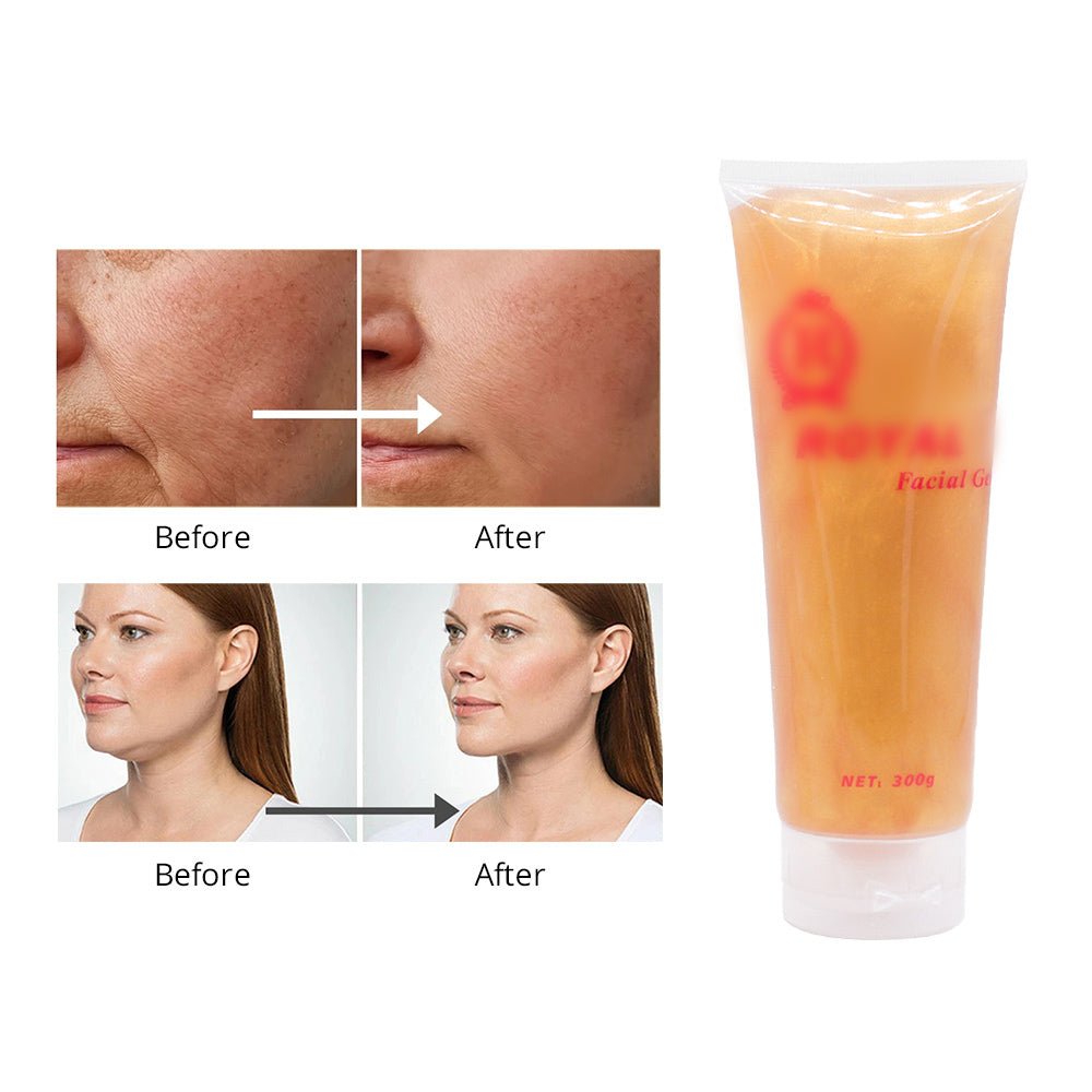 Shape Tactics Cavitation RF Hydra-Tightening Gold Gel – Cavitation Machines, view 4