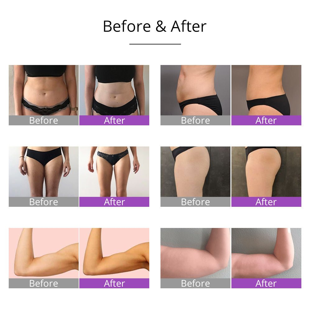 Shape Tactics 6-in-1 Cavitation RF Vacuum Lipo Laser Contouring System – Cavitation Machines, view 16
