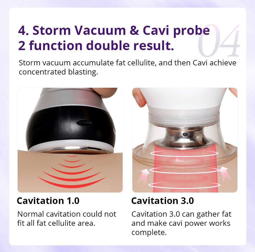 Shape Tactics Cavstorm 40K Cavitation 3.0 with Microcurrent RF System – Cavitation Machines, view 19