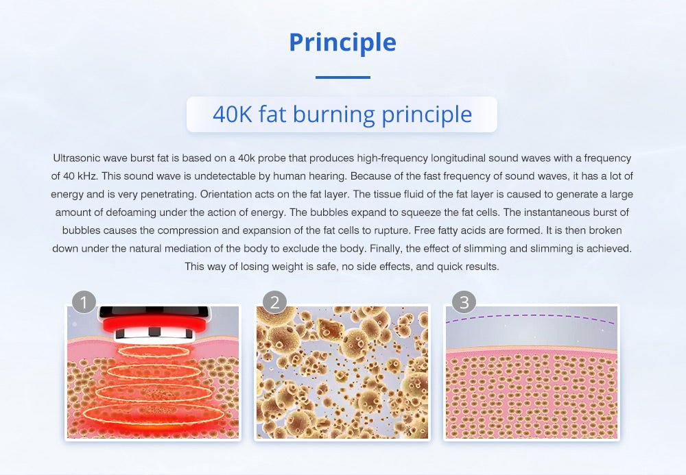 Shape Tactics Cryotherapy 40K Cavitation & RF Contouring System – Cavitation Machines, view 9
