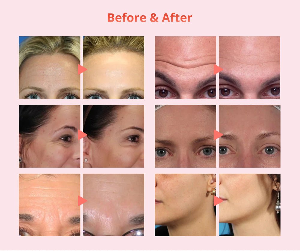 Shape Tactics Diamond Dermabrasion & Ultrasonic Skin Care System – Cavitation Machines, view 13