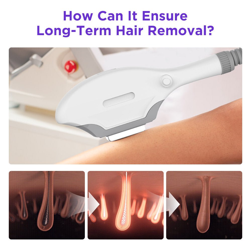 Shape Tactics IPL Hair Removal and Skin Rejuvenation System – Cavitation Machines, view 10