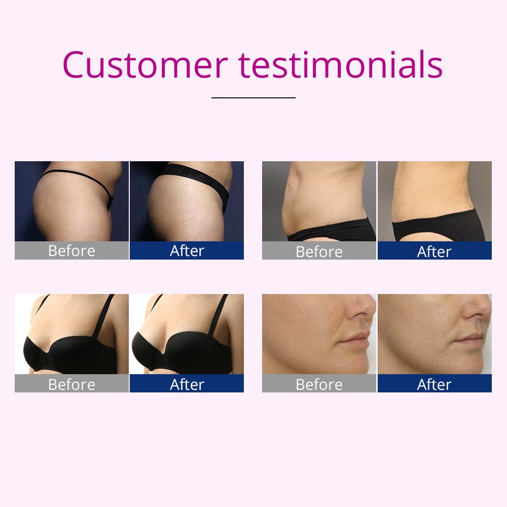Shape Tactics Microcurrent Electrode Stimulation Body Shaping Machine – Cavitation Machines, view 16