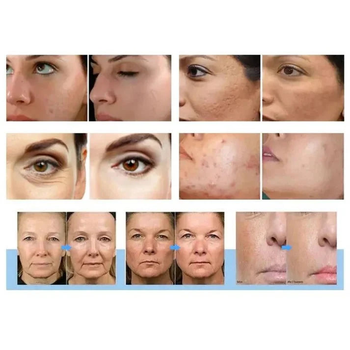 Shape Tactics Morpheus 3-in-1 Gold RF & Cold Therapy System – Cavitation Machines, view 15