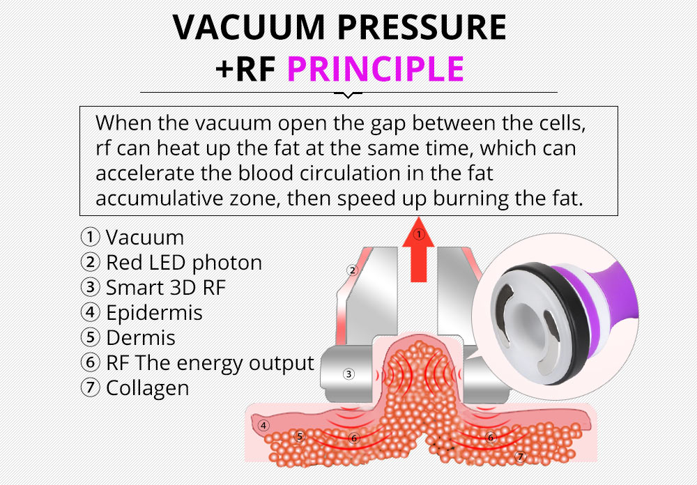 Shape Tactics 5-in-1 Ultrasonic Cavitation Vacuum RF Beauty System – Cavitation Machines, view 12