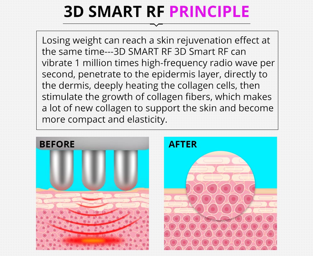 Shape Tactics 5-in-1 Ultrasonic Cavitation Vacuum RF Beauty System – Cavitation Machines, view 11