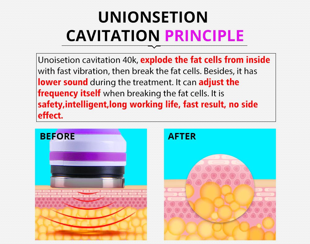 Shape Tactics 5-in-1 Ultrasonic Cavitation Vacuum RF Beauty System – Cavitation Machines, view 10