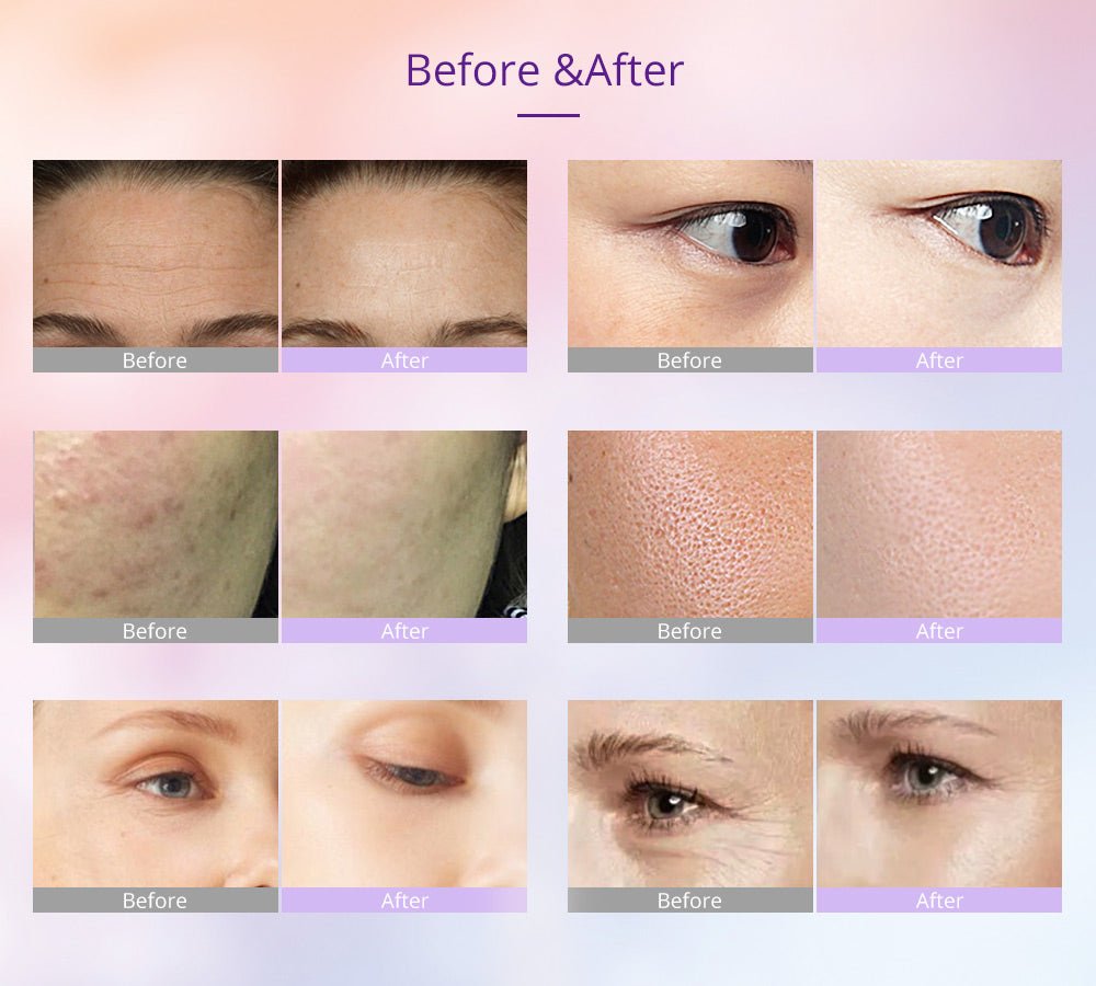 Shape Tactics Photon LED Facial Care Microcurrent Beauty Device – Cavitation Machines, view 11