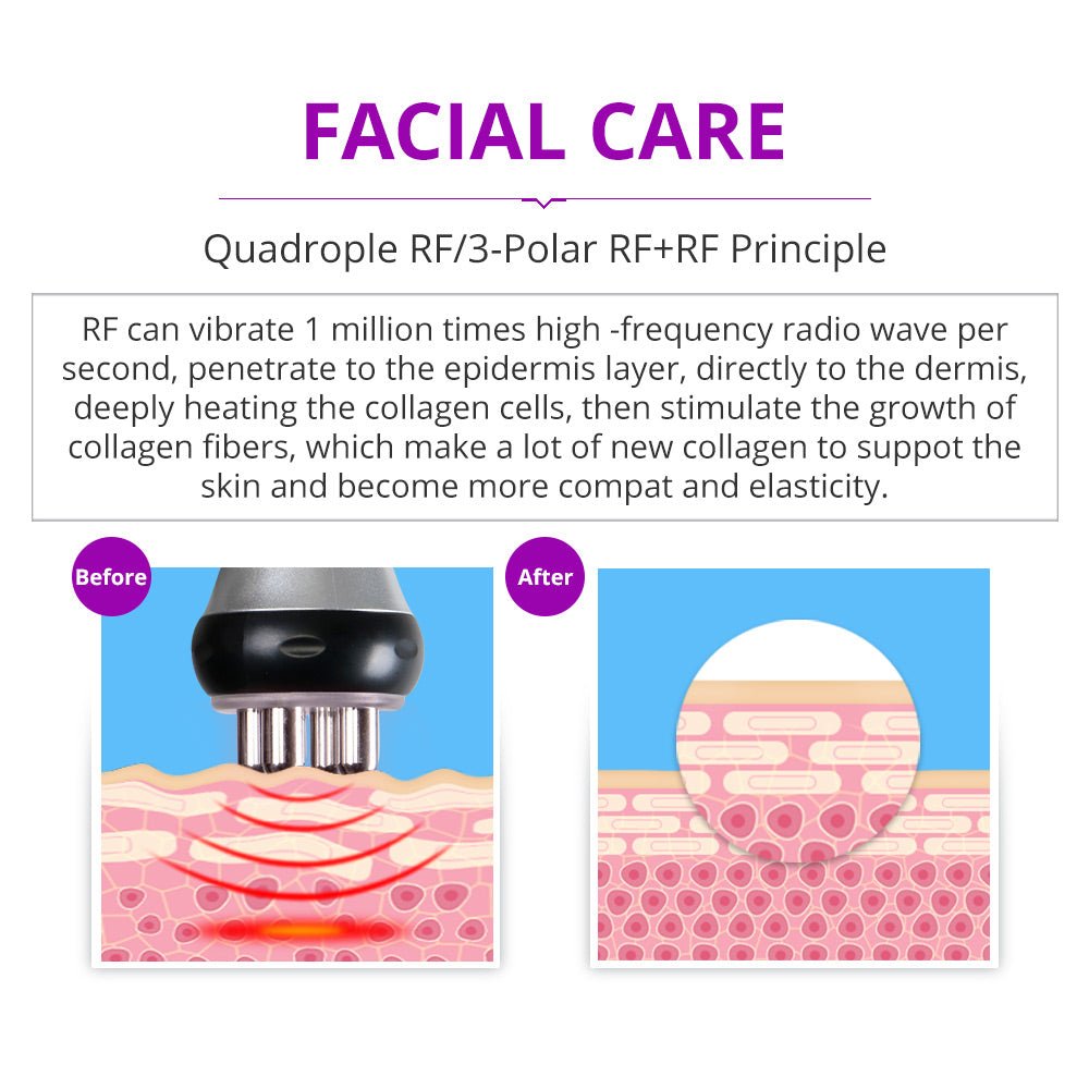 Shape Tactics Portable 5-in-1 Cavitation RF Vacuum Contouring System – Cavitation Machines, view 9