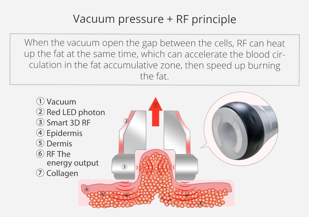 Shape Tactics Portable 6-in-1 Cavitation RF Vacuum Lipo Laser System – Cavitation Machines, view 9