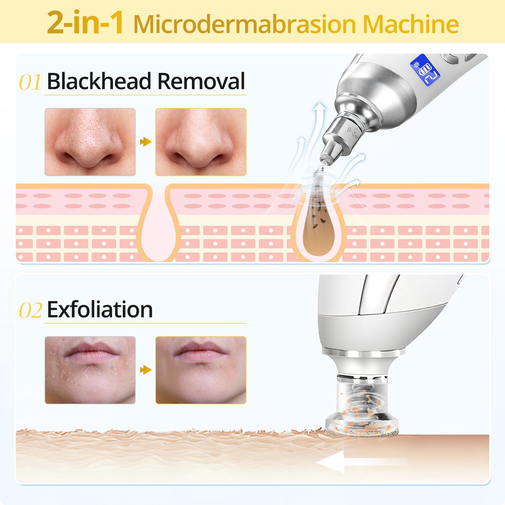 Shape Tactics Portable Diamond Microdermabrasion Device – Cavitation Machines, view 8