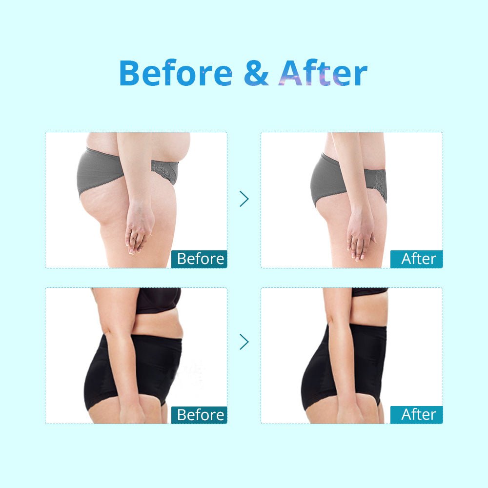 Shape Tactics Portable Double-Handle Cryolipolysis Contouring System – Cavitation Machines, view 13