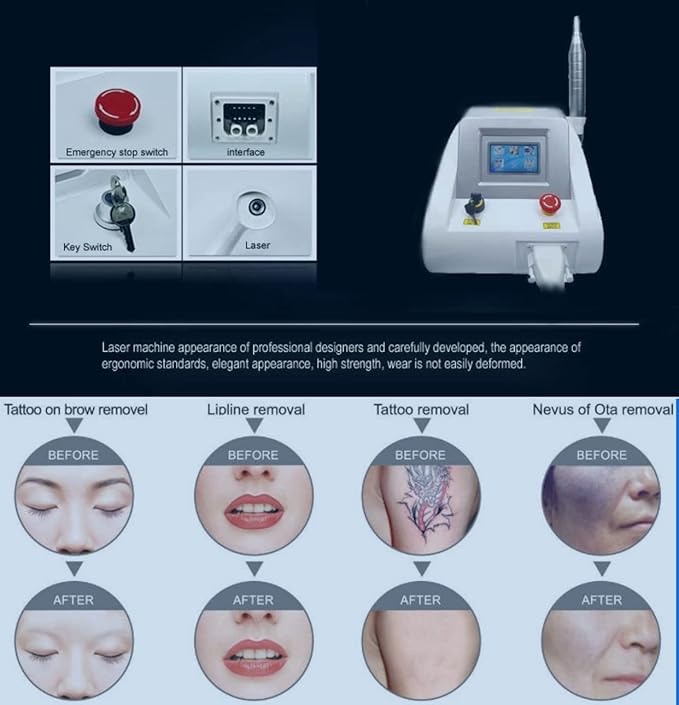 Shape Tactics Precision Picosecond Laser System – Cavitation Machines, view 13