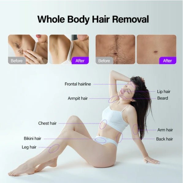 Shape Tactics Soprano Ice Pro 4-in-1 Laser Hair & Skin System – Cavitation Machines, view 7