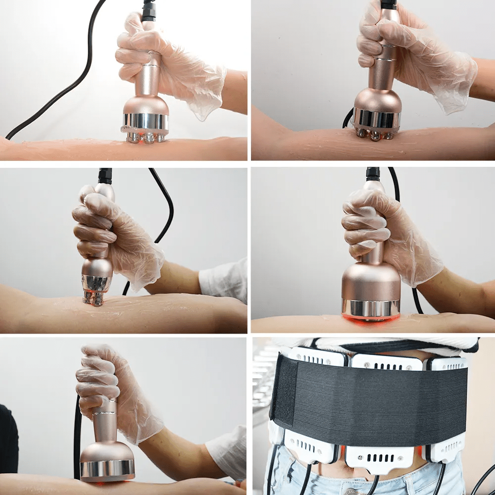 Shape Tactics ProElite 40K RF Lipo Laser System – Cavitation Machines, view 9