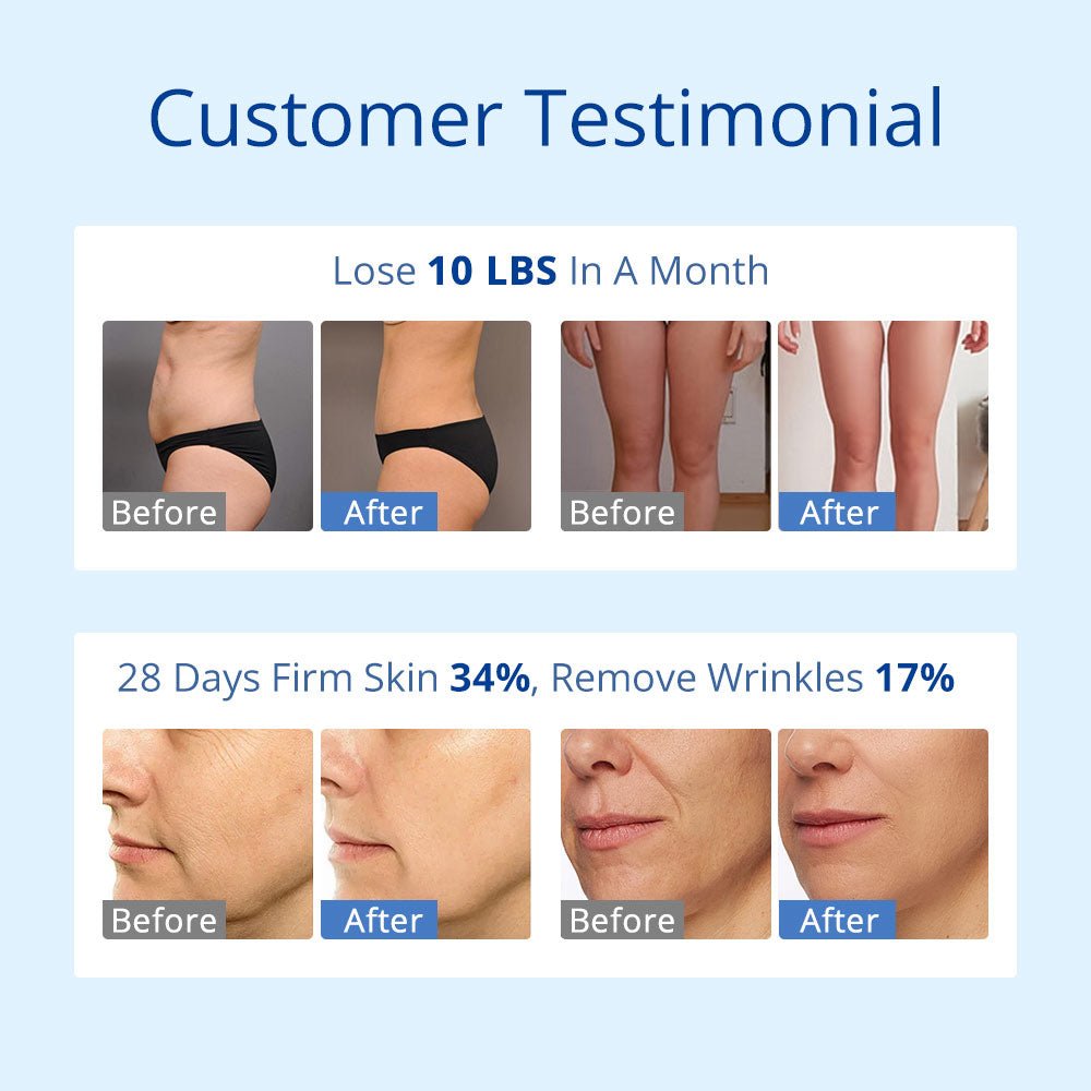 Shape Tactics S-Shape 30K Cavitation RF & 160mW Lipo Laser System – Cavitation Machines, view 13