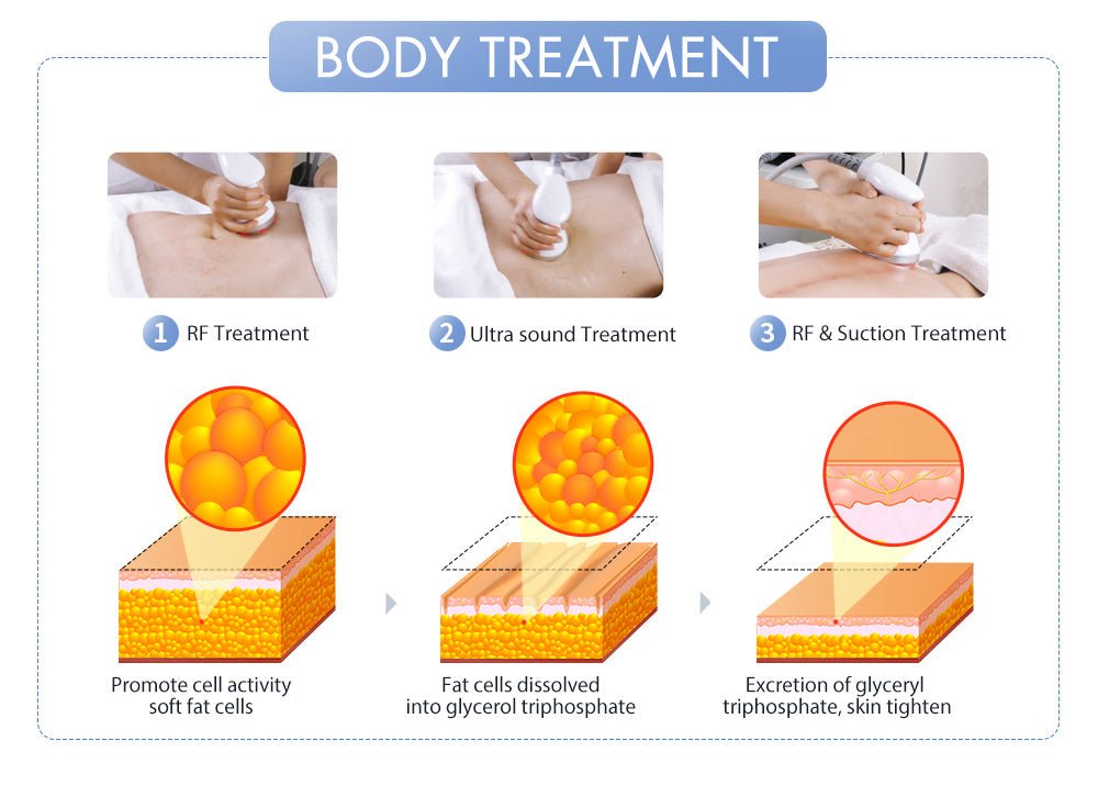 Shape Tactics S-Shape Pro 30K Cavitation RF Contouring System – Cavitation Machines, view 12
