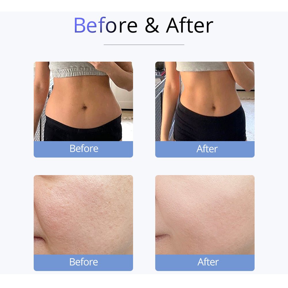 Shape Tactics S-Shape 30K Ultrasonic Cavitation & RF Vacuum Therapy System – Cavitation Machines, view 15